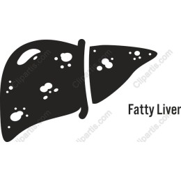 Fatty Liver