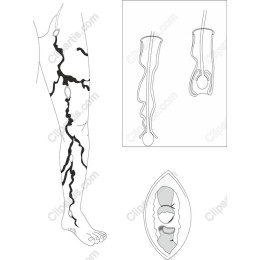 Abstract Leg
