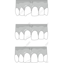 Dental Health Evolution