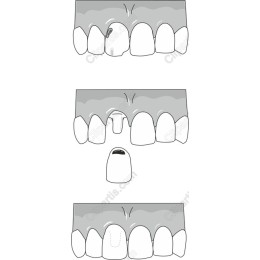 Dental: Teeth Structure Explained