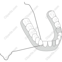 Dental Retainer