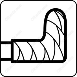 Seamless Corner Connector