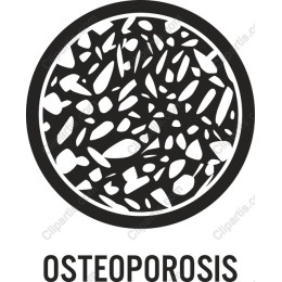 Osteoporosis