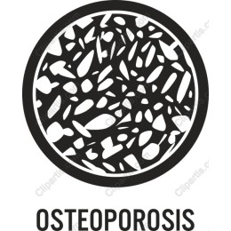 Osteoporosis