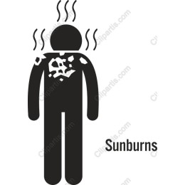 Sunburns