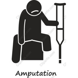 Amputation
